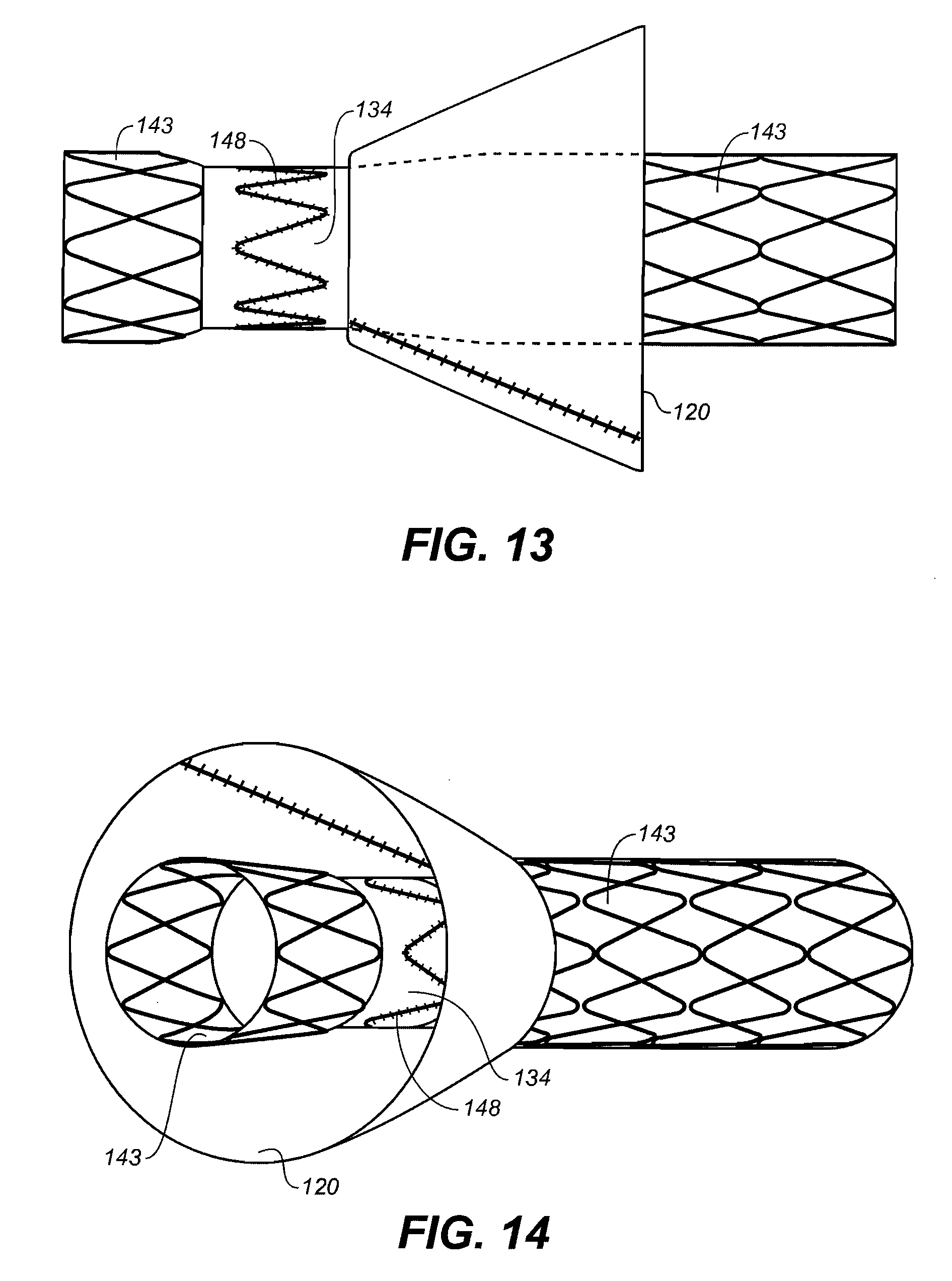 Dacron Cuff Purpose