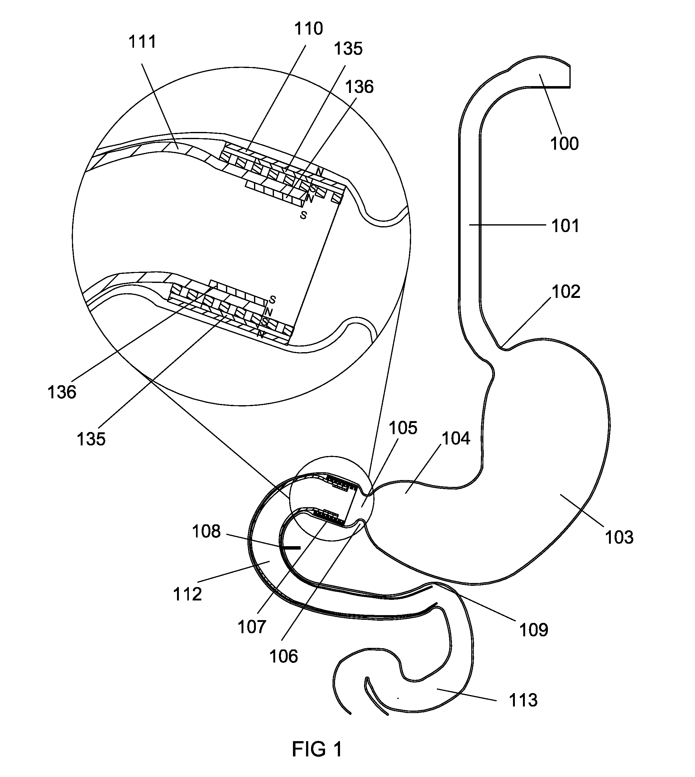 Dacron Cuff Purpose