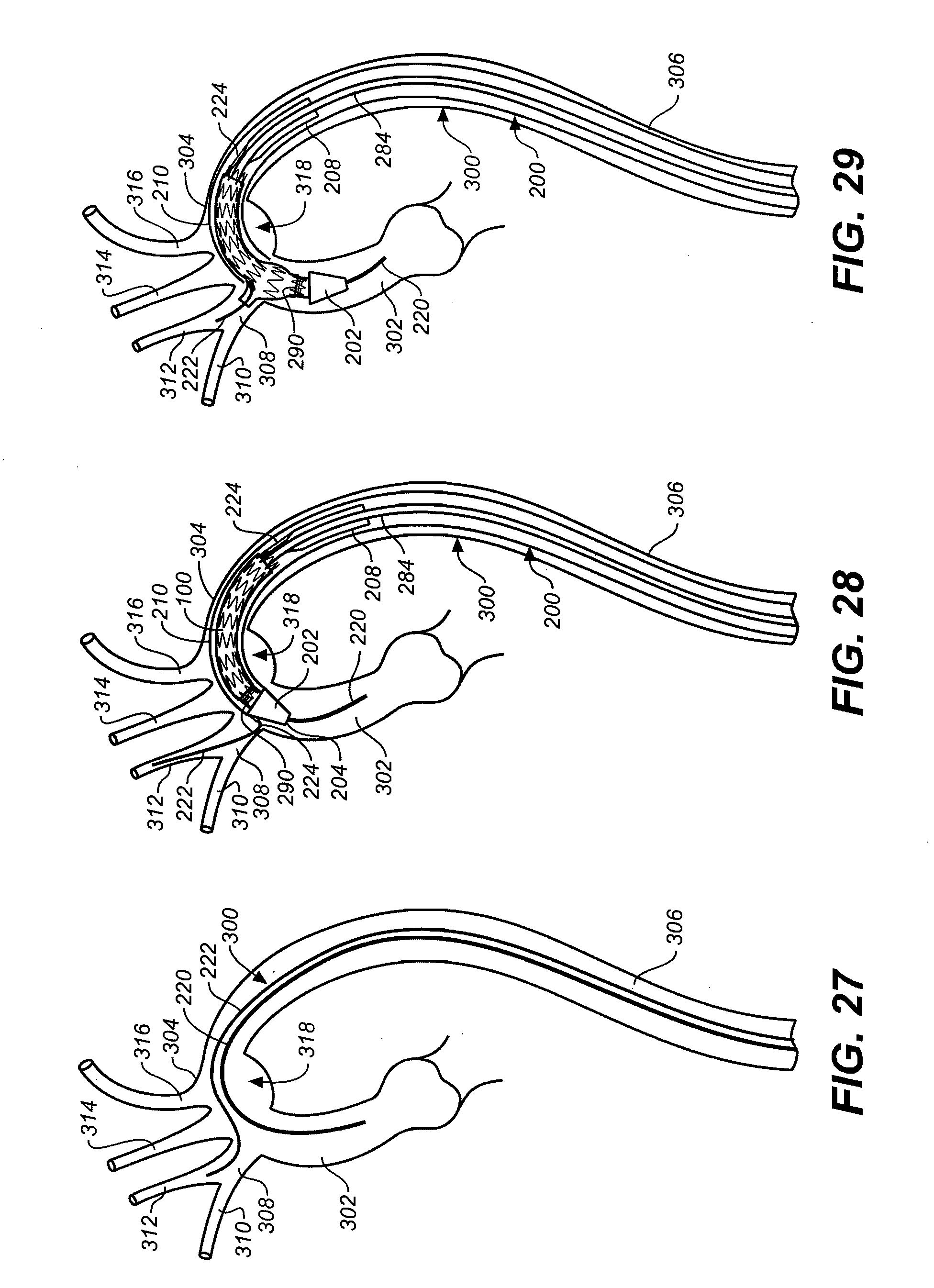 Dacron Cuff Purpose