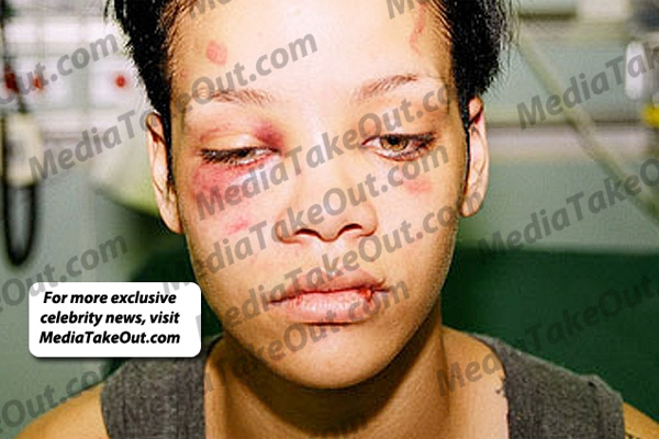 Rihanna And Chris Brown Assault 2009